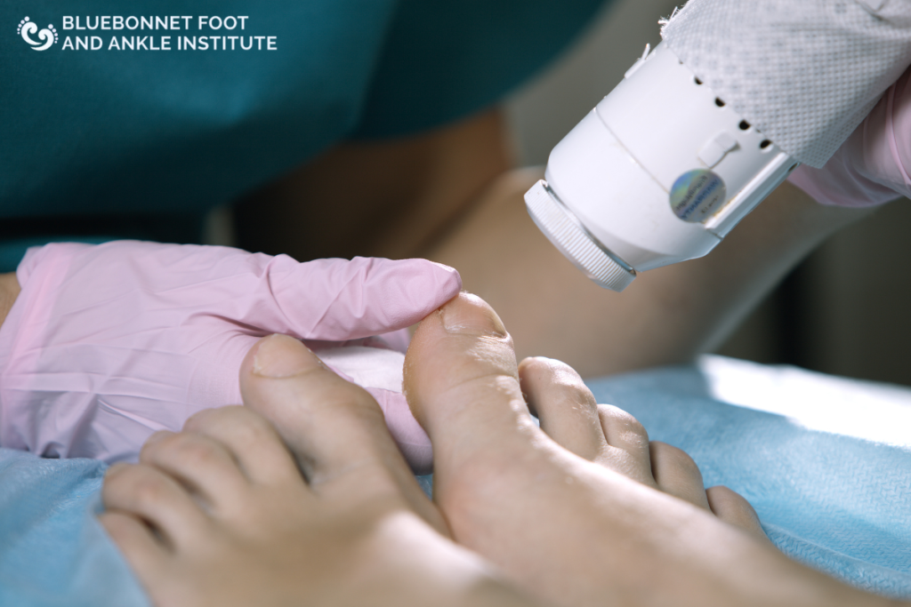 A patient getting laser treatment for toenail fungus in exas.